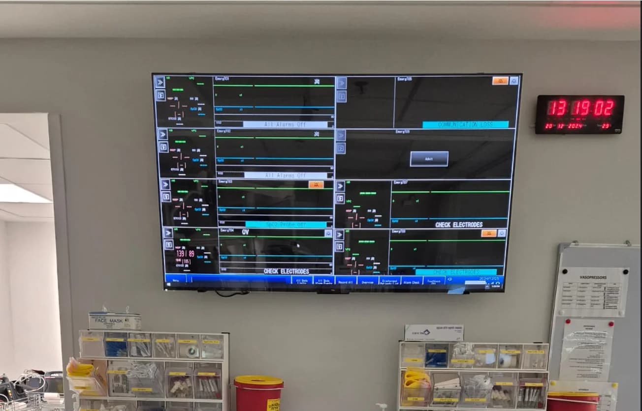 מגן מסך לטלוויזיה 100 אינץ' – הגנה אקרילית שקופה עם סינון אור כחול