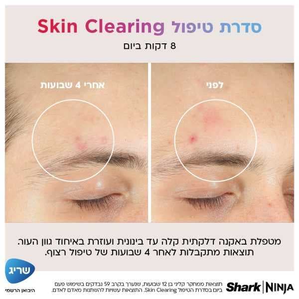 מסכת לד לפנים Shark Beauty CryoGlow FW312EU שארק עם 480 נורות iQLED וקירור InstaChill יבואן רשמי