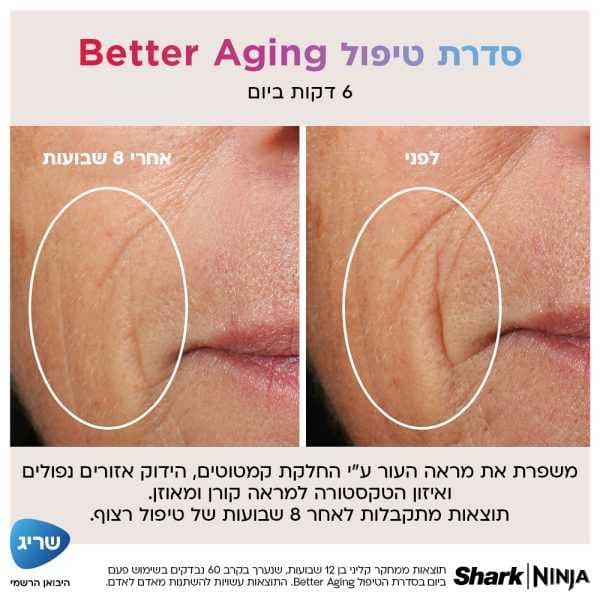 מסכת לד לפנים Shark Beauty CryoGlow FW312EU שארק עם 480 נורות iQLED וקירור InstaChill יבואן רשמי